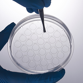 CellSLIP?細胞爬片培養(yǎng)皿,共聚焦培養(yǎng),細胞爬片