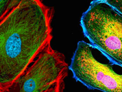 無自發(fā)熒光，成像效果佳，可用于熒光顯微實(shí)驗(yàn)、激光共聚焦顯微實(shí)驗(yàn)、熒光原位雜交（FISH）和相差顯微實(shí)驗(yàn)等